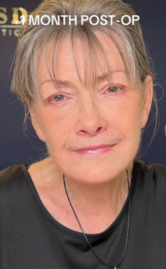 femeie operatii estetice