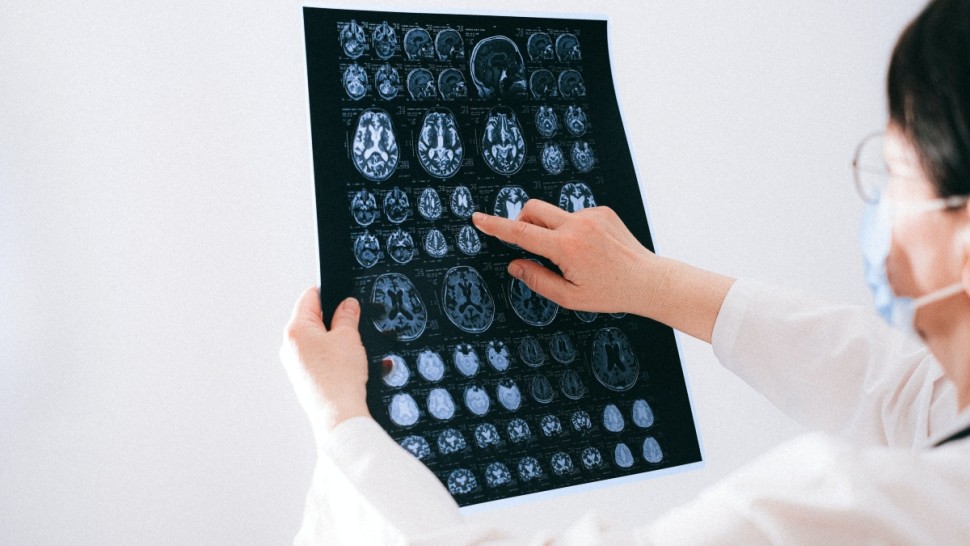 Un studiu recent dă peste cap tot ce se credea despre COVID Nu lasă sechele permanente în creier