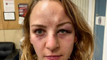 Campioană olimpică bătută cu sălbăticie de antrenorul ei