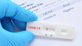 Varianta Omicron mai greu detectabilă de testele antigen