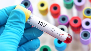 Prima femeie din lume care s-a vindecat de HIV. Specialiștii spun că e un mare succes dar terapia e riscantă
