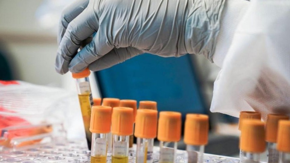 OMS sfătuiește Ucraina să distrugă orice agenţi patogeni pe care îi are în laboratoare