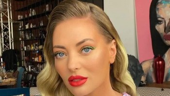 Delia mărturisirea momentului. Artista vorbește pentru prima dată despre afecțiunea care-i dă bătăi de cap