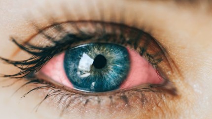 O aplicație pentru smartphone poate detecta bolile în ochi. Care sunt semnele care avertizează că e nevoie de un consult medical