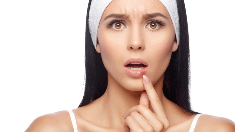 Top 7 remedii în caz de herpes. Aplică și tu
