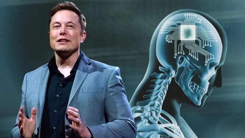 Elon Musk vrea să implanteze cipuri în creierele oamenilor anul acesta. Tehnologia a fost autorizată în SUA