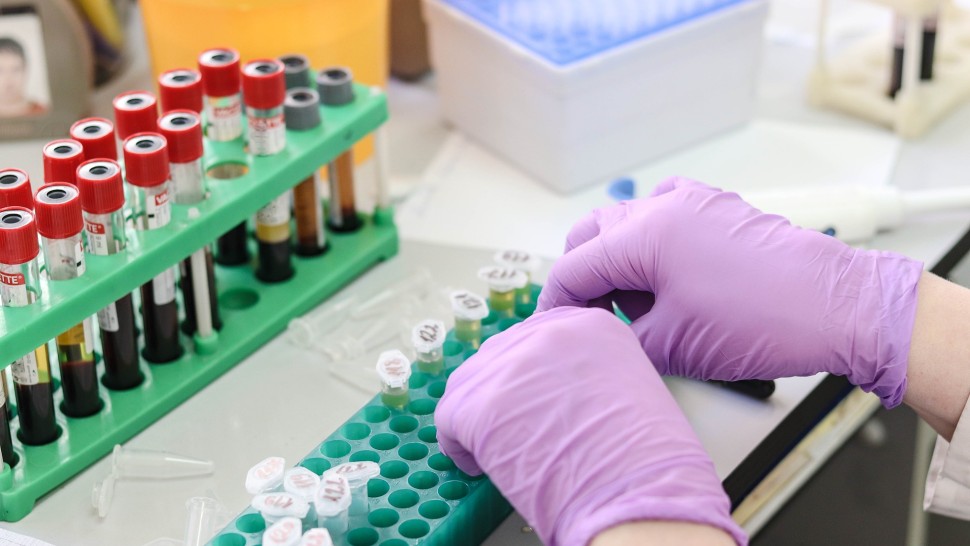 Analize medicale gratuite. Lista investigațiilor decontate anual de CNAS