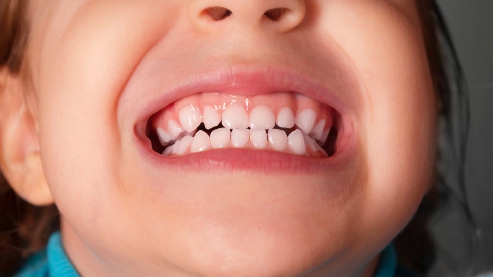 Revoluție în stomatologie. Medicament pentru regenerarea dinților lipsă testat în Japonia