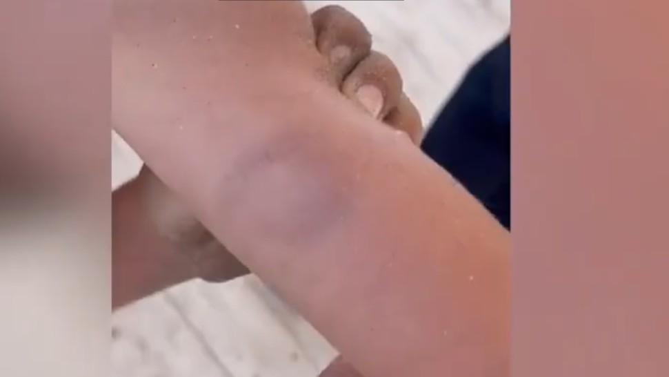 Copil de 6 ani mușcat de o femeie pe plajă Turista de 42 de ani a devenit recalcitrantă VIDEO