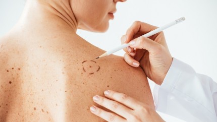 Boala agresivă care afectează tot mai mulți români. Risc mare la o anumita categorie