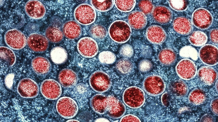 De ce este variola maimuței din nou o urgență și cât de îngrijorați ar trebui să fim de mpox