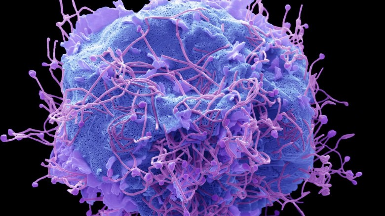 Metapneumovirusul care face ravagii în China ajunge în România. Cum ne protejăm de virusul descoperit în 2001