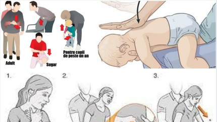 Manevra Heimlich. Cum se realizează metoda prin care poți salva viața unui bebeluș sau chiar a unui adult