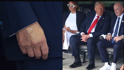 Riscurile bolii lui Donald Trump. Cât de grav e diagnosticul anunțat de Casa Albă