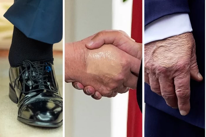 Riscurile bolii lui Donald Trump