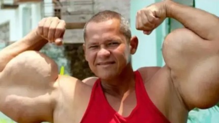 Adevăratul Popeye controversatul culturist care își injecta ulei în brațe a murit. Avea bicepși de 73 de centimetri