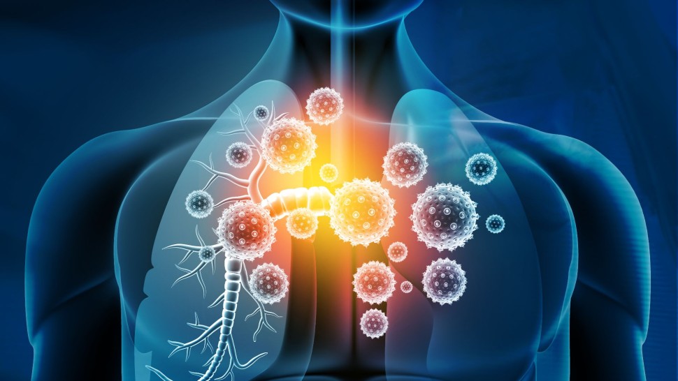 Bubuie cazurile de infecții respiratorii. INS bilanț îngrijorător