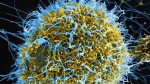 Alertă la nivel mondial privind Ebola. Peste 900 de cazuri suspecte în Congo anunţă OMS