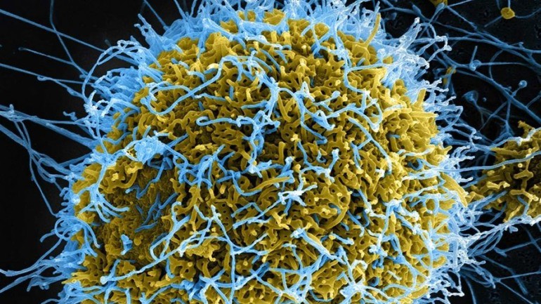 Alertă la nivel mondial privind Ebola. Peste 900 de cazuri suspecte în Congo anunţă OMS
