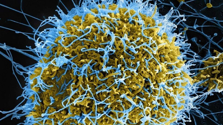 Alertă la nivel mondial privind Ebola. Peste 900 de cazuri suspecte în Congo anunţă OMS