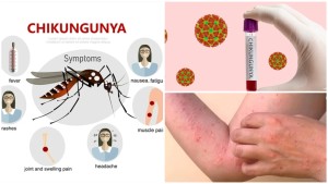 Un virus tropical care provoacă epidemii tot mai aproape de Europa. Simptomele infecției cu chikungunya