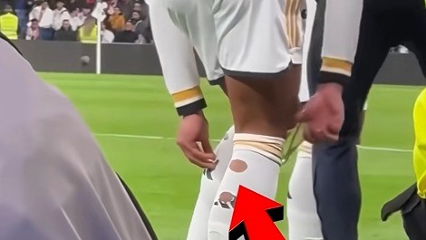 De ce fotbaliștii de la Cupa Mondială au găuri în ghete și șosete. Explicația din spatele trendului bizar